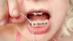 Reproducir 2do día en corsé - hilo dental - bloque verbalizar hechizo