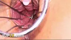 Riproduci Apri il suo buco del ginecologo molto seriamente